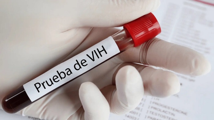Prueba de VIH (detalle en la foto) de una persona que posiblemente tenga el virus.