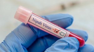El virus del Nipah (ver detalle en foto), fue identificado en el Sudeste asiático y la India.