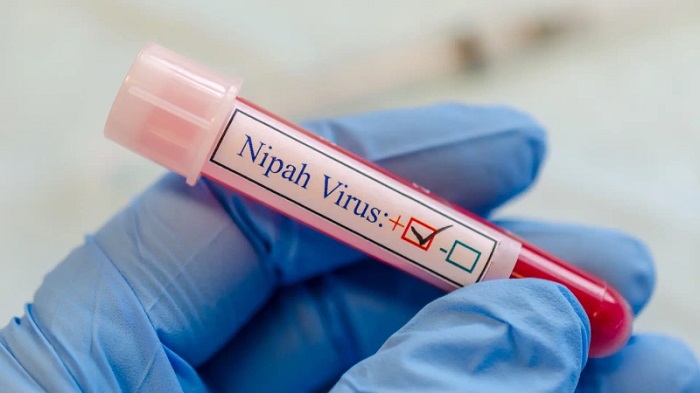 El virus del Nipah (ver detalle en foto), fue identificado en el Sudeste asiático y la India.